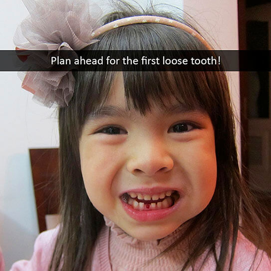 Plan Ahead For The First Loose Tooth Bristol Park Dental 8825