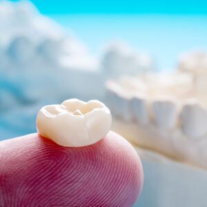 dental crowns near me